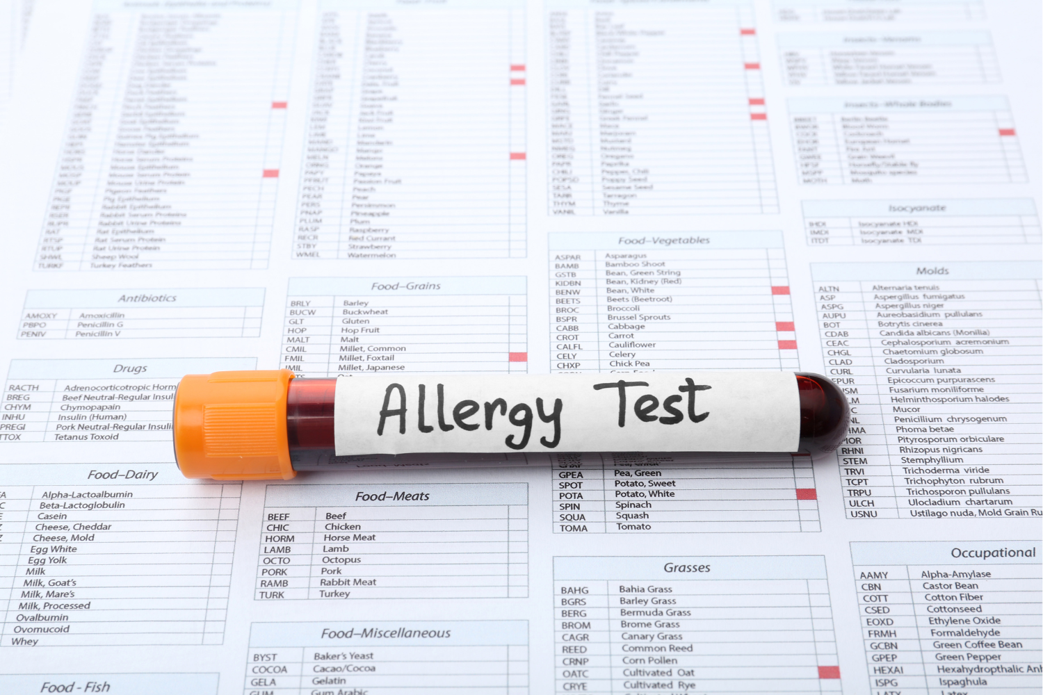 Nuovo test molecolare Alex2 per diagnosticare le allergie